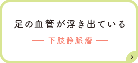 足の血管が浮き出ているー下肢静脈瘤ー